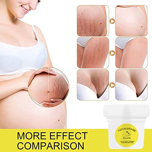 Creme de açafrão para redução de cicatrizes, creme firmador orgânico impecável, creme de estria pós-