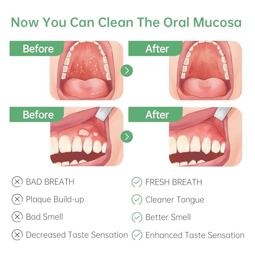 Tongueclear Oral Mucosal Cleaner|Silicon Oral Care Cleaner|Gum Massager with Air Bag(1 pc)