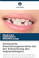 Gesteuerte Knochenregeneration bei der Entwicklung des Implantatlagers (German Edition) 6200710988 Book Cover