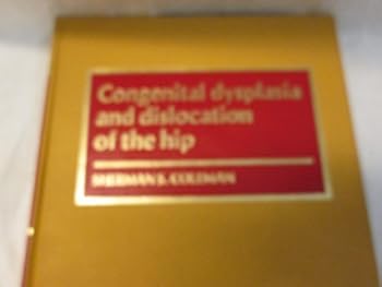 Hardcover Congenital dysplasia and dislocation of the hip Book