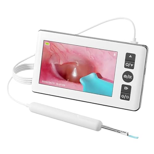 可視 耳かき 4.3インチ 専用ディスプレイ付き カメラ付き 1080P HD USB充電式 長航続 多機能 プレゼント