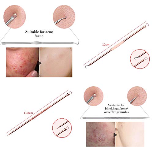 Ztrhyoo BIANTI-FCZ-NEWPINK Blackhead Remover Pimple Comedone Extractor Tool Best Acne Removal Kit thumb #4