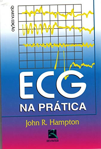 ECG na Prática
