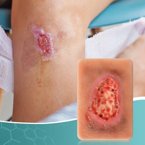 Image of Wet Necrotic Wound Simulation Model