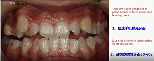 Adhesivo ortodoncia OrthoForce kit de cemento dental para brackets de metal 3