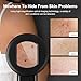 Handheld Dermatoscope, 100X Magnification Skin & Scalp Analyzer, 16MP Camera for Hair Follicle Observation & Blackhead Inspecting, Digital Microscope with 2