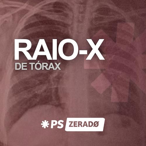 Raio-X de Tórax no Plantão Sinais Clássicos sem Mistério