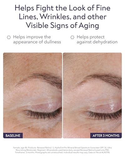 Image of ALASTIN Skincare Renewal Retinol Serum (.25 Strength, 1.0 oz)