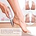 Powerful Electric Callus Remover Wand – Rechargeable Foot File, Grinder & Scrubber - Removes Dead, Hard Skin & Calluses – Best Pedicure Tool for Soft, Smooth Feet for Men & Women (Rose Gold)