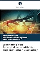 Erkennung von Prostatakrebs mithilfe epigenetischer Biomarker (German Edition) 6208725534 Book Cover