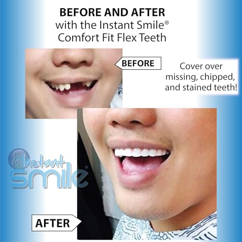 Image of Instant Smile Flex Teeth (Bright White Shade) and Pro Series Tooth Kit - 2 Great Instant Smile Products