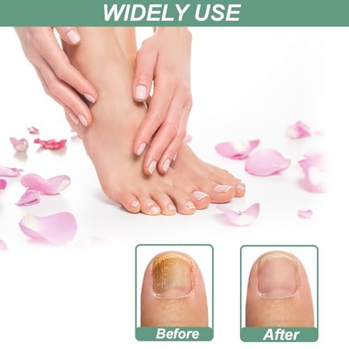4 Pezzi Nail Care Pen, Penna per la Cura Delle Unghie, Arricchito con Tea Tree Oil, Fiori di Camomilla, Aloe Vera