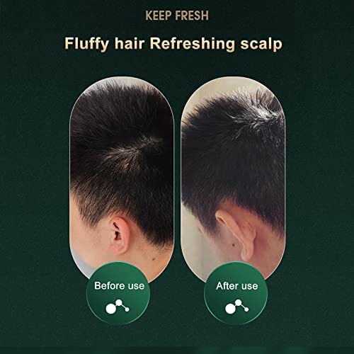 Xlaq Scalp Exfoliator, Scrubber For Hair Growth, Centella Purifying Scrub, Anti-Dandruff, Anti-Itch And Oil-Removing Sea Salt Shampoo,Natural Plant Shampoo Exfoliate Scrub #TOP3