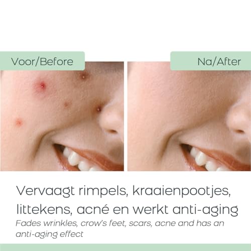 Orange Care Baba de Caracol Crema Viso 50 ml