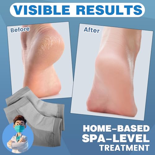 Image of TEAWOO 6 Pairs Grey Moisturizing Heel Socks for Cracked Heel Treatment