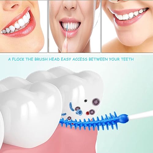 FaJoek Interdentale borstels, 200 stuks, tandenstokers, 0,7 mm, tandenstoker, tandenverzorgingsborstel, voor het reinigen van de tanden (Blau:200PCS, set) – Bild 3