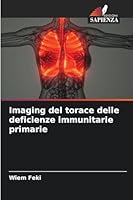 Imaging del torace delle deficienze immunitarie primarie 6209277357 Book Cover