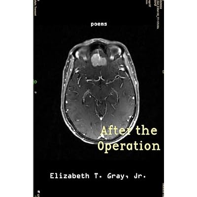 After the Operation