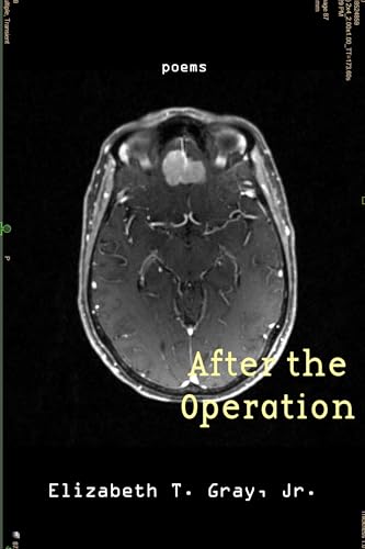 After the Operation