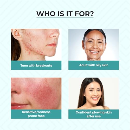 Image of Dr. Sakhiya's 4-Step Acne & Pimple Kit for Oily & Acne-Prone Skin | 2% Salicylic Face Wash, Azelaic Day Cream, SPF 50 Sunscreen & Retinol Night Cream | Complete Dermatologist Formulated Routine