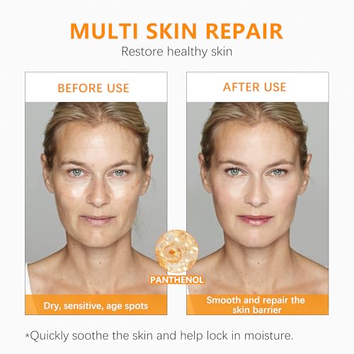 MAVENI Super Vitamin C Serum for Women over 70 With Hyaluronic Acid, Reduce Wrinkle, Hydrates, Firms, Lifts, Anti Aging Serum for Dark Spots, Wrinkles, DullSkin, 1 fl.oz