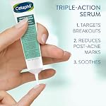 Cetaphil Gentle Salicylic Acid Acne Serum, Pore Minimizer Serum for Sensitive Acne-Prone Skin, Niacinamide & Zinc Acne Treatment, Hypoallergenic, Dermatologist Recommended