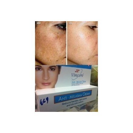 Best Cream Anti Melasma Reduces Dark & Brown Spots, Age Spots, Sun Spots, Pigmentation, Freckles 15 G.