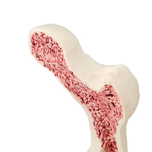 Image of ZJchao Osteoporosis Spine Model, ABS Anatomical Osteoporosis Model, Pathological Changes Visualization Versatile Learning Tool for Anatomy Education Constructed