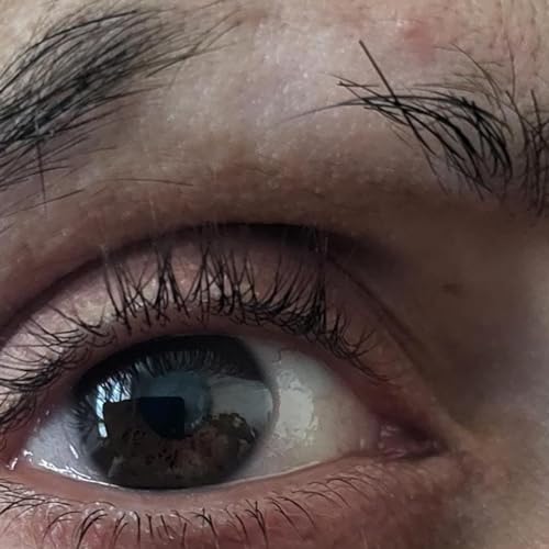 "Brow Deep: Unraveling the Emotions Behind My Lost Eyebrow" Part I