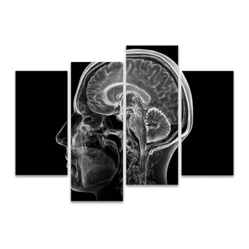 4Pcs Canvas Wall Art Framed Wall Art for Living Room mri brain human head brain pictures Modern Wall Decor Prints Pictures on Artworks Home Decor