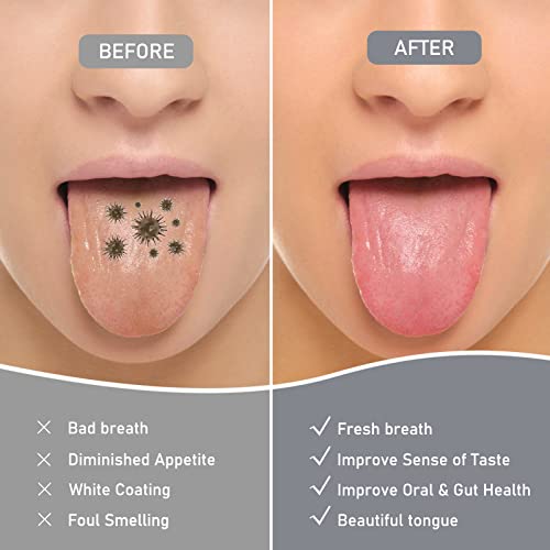 Amazon Brand-Hlflyg 4 Pack Tongue Scraper, Hygienic Seal-Pack, Professional Eliminate Bad Breath, Stainless Steel Tongue Scrapers,100% Effectively Improve Oral And Gut Health -Silver #TOP1