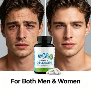Hydrolysierte Kollagenproteinkapseln – für Frauen und Männer | Multi-Kollagen-Kapseln mit Peptiden für Haut, Falten, Haare, Nägel, Gelenke, Erholung