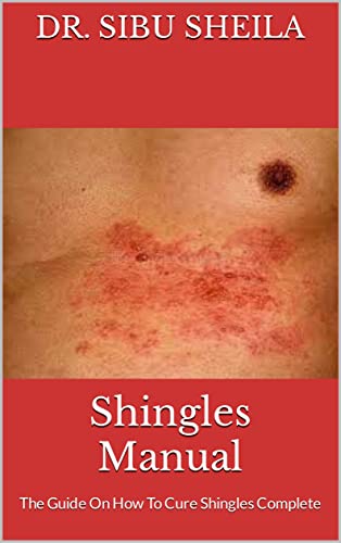Shingles Manual : The Guide On How To Cure Shingles Complete