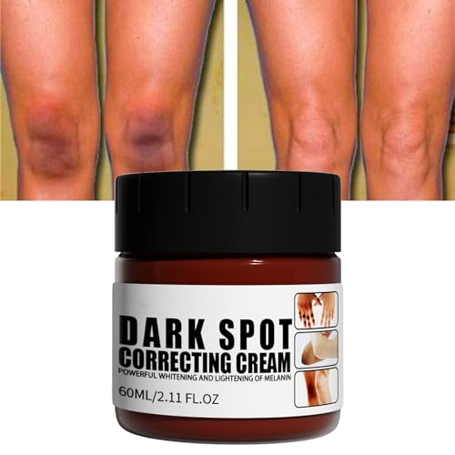 Whitening Cream, Crema Blanqueadora Corporal, Crema Hidratante Aclarante y Anti Manchas, Crema Blanqueadora para Aclarar las Manchas Corporales, para Piel Oscura en Axilas, Cuello, Codo