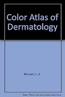 Color Atlas of Dermatology 0912791039 Book Cover