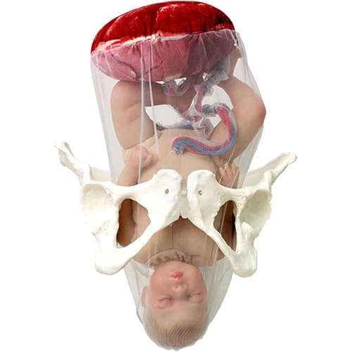 Female Childbirth Model, Midwifery Training Model Dynamic Childbirth Simulation Tool with Separable Baby and Pelvis Umbilical Cord for Gynecology Teaching