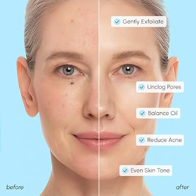 MAREE Glycolic Acid Pads & 2% Salicylic Acid Toner Pads for Face with 20% Glycolic Acid Solution Face Exfoliating Pads, Acne Clearing Face Pads Skin Pore Resurfacing & Radiance Device 50 Count