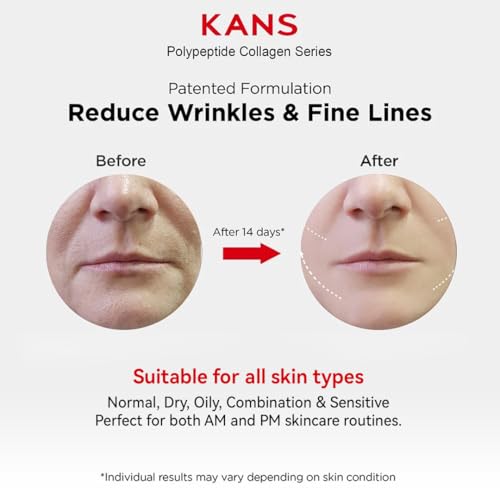 Image of KANS Collagen Boosting Copper Peptide Anti-Aging Serum 30 ml, Advanced Anti-Aging Face Serum, Korean Glow Cyclohexapeptide-9, Patented Tiracle PRO, Boosts Collagen, Reduces Fine Lines & Wrinkles
