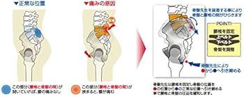 Amazon.co.jp: SKP整体が作った骨盤先生こつばんせんせい 骨盤用