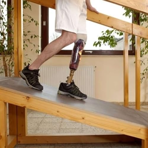 T&ecirc;te-&agrave;-t&ecirc;te avec un m&eacute;tier - Emma Alves, orthoproth&eacute;siste