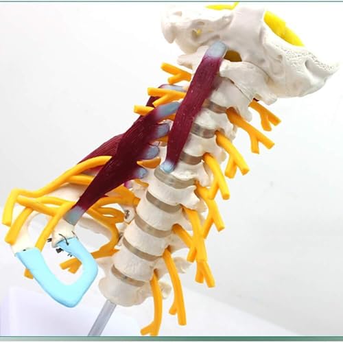 Modèle d'araignée cervicale AMITD dans votre cabinet pour expliquer l'anatomie