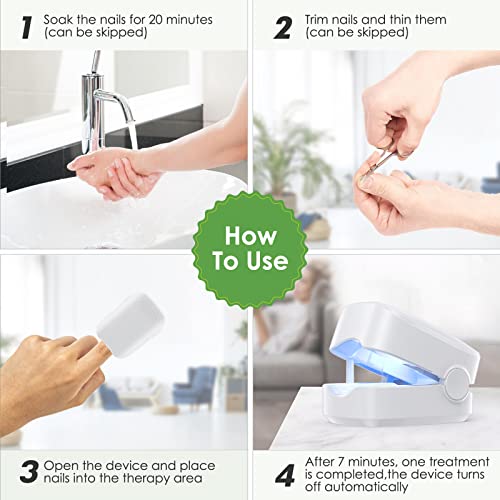 2 Pack Of Nail Fungus Cleaning Laser Device, 2 Pack Of Nail Therapy For Damaged Discolored Thick Toenails & Fingernails, Effective Rechargeable Nail Fungus.extensive Restoration #TOP5