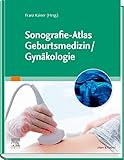  Sonografie-Atlas Geburtsmedizin/Gynäkologie