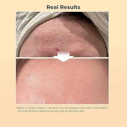 Blusheva Beauty Snail Mucin Radiance Serum 96% — view 6