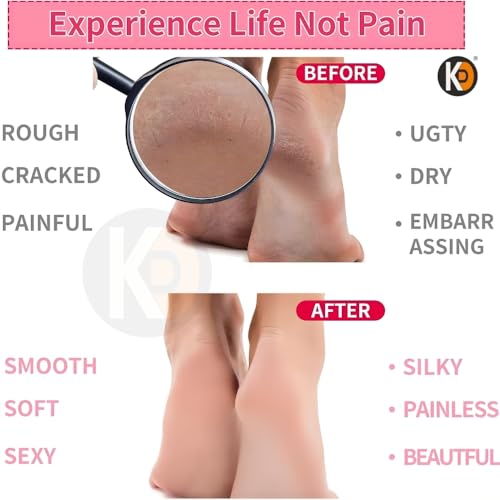 Image of K D Socks for Women, Crack Heel Repair Socks, Spa Gel Socks for Women, Silicon Socks, Silicone Socks for Men, Foot Hydration Socks Vitamin E-Multicolour (Women Gel Gloves)