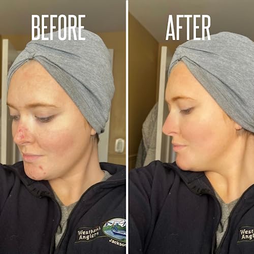 Glycolic Acid Pads, Chemical Peel For Face At Home With 20% Glycolic Acid And Vitamin C - Exfoliating Face Pads, Glycolic Acid Peel For Face Exfoliating Pads -Face Cleansing Pads 50 Cotton Facial Pads #TOP4