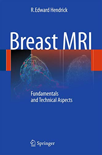 Breast MRI: Fundamentals and Technical Aspects