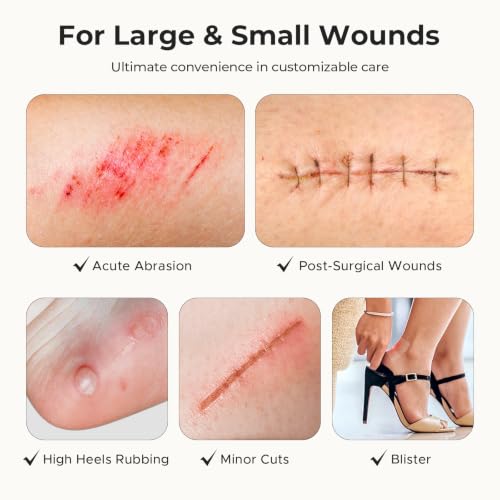 Image of TKTK Hydrocolloid Roll 2 Sizes, Cut-to-Fit Bandages for Pimple & Wounds