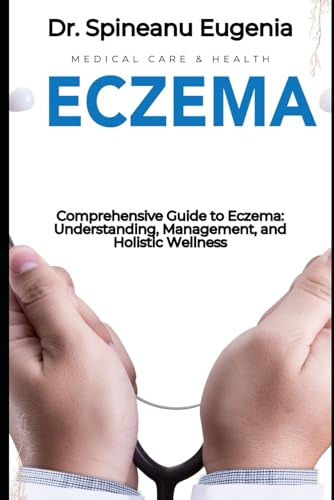 Comprehensive Guide to Eczema: Understanding, Management, and Holistic Wellness