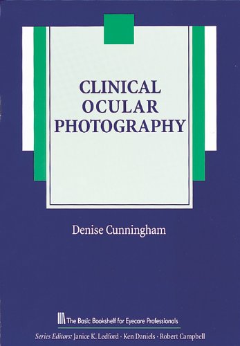 Clinical Ocular Photography (The Basic Bookshelf For Eyecare Professionals) #TOP2